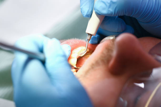 Best Pediatric Emergency Dentist in Diboll, TX