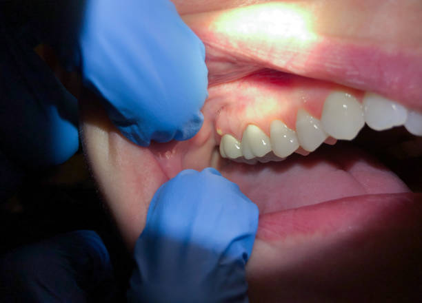 Best Same-Day Emergency Dentist in Diboll, TX