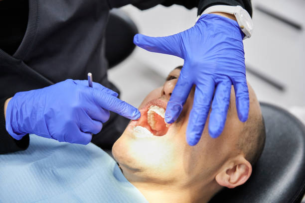 Best Emergency Wisdom Teeth Removal in Diboll, TX